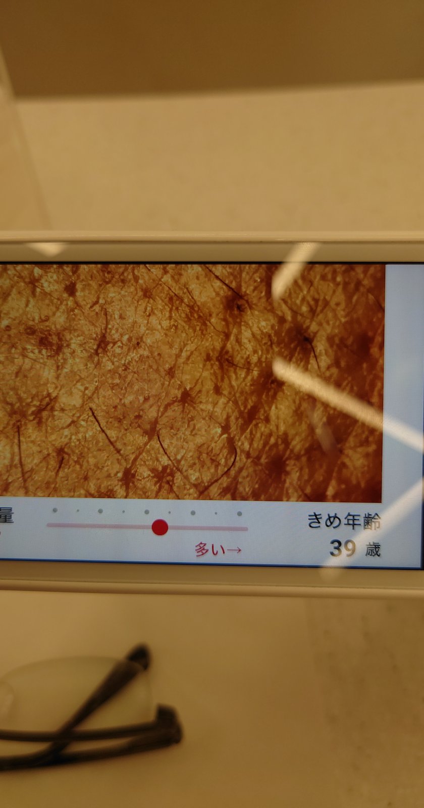 業務用機器の肌診断画面：水分量57（中程度）の表示と肌の拡大画像